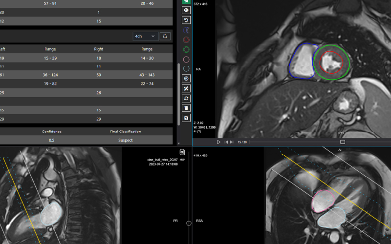 Portuguese innovation set to revolutionise cardiac MRI